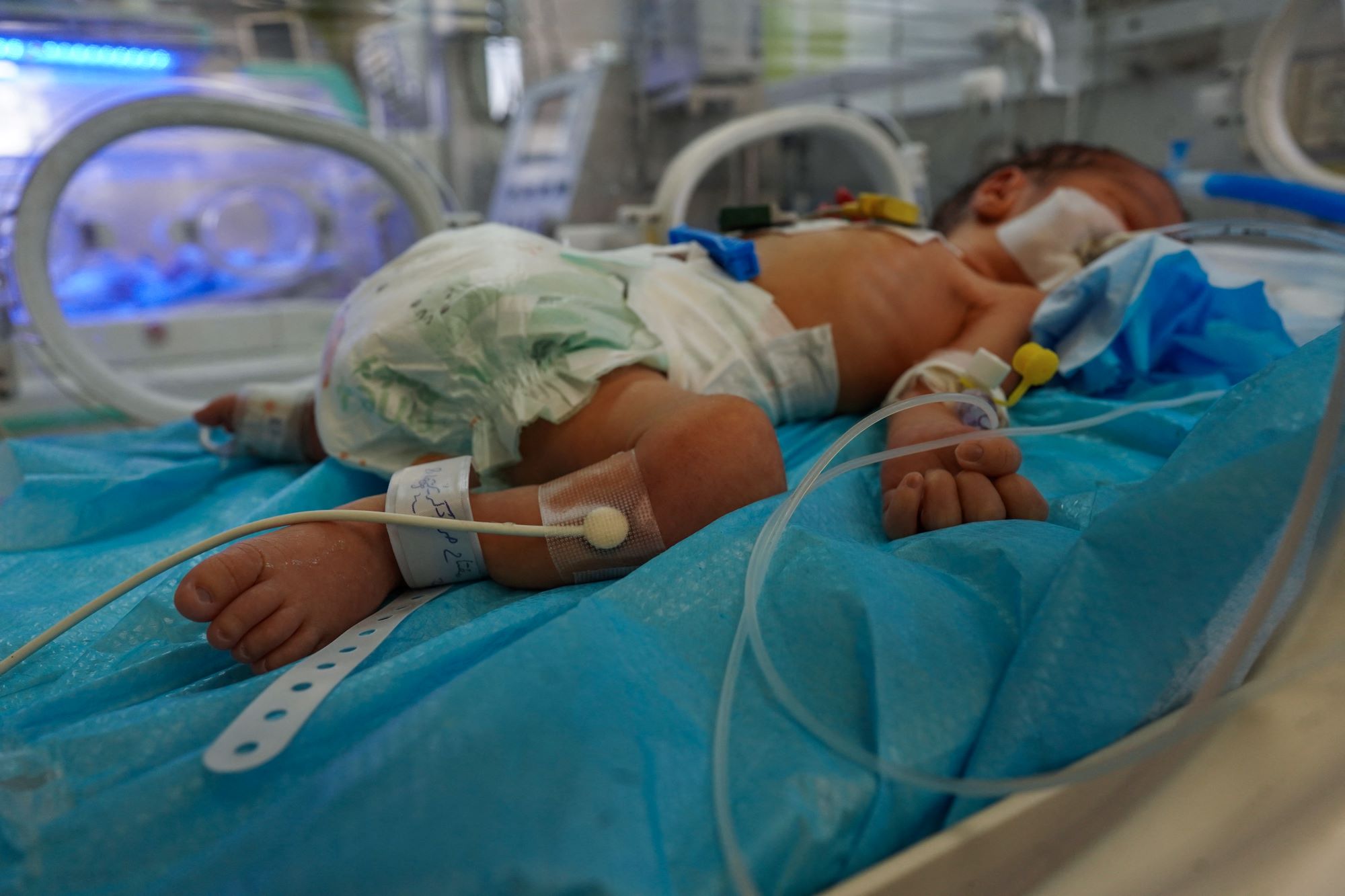 طفل حديث الولادة في حاضنة مستشفى ناصر بمدينة خان يونس (الفرنسية)